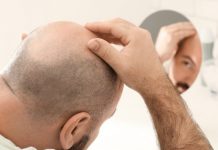 Saç ekimi ne zaman yapılmalı? Saç ekimi ne zaman yapılmalı?