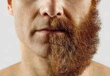 Sakaldan saç ekimi nasıl yapılır? Sakaldan saç ekimi nasıl yapılır?