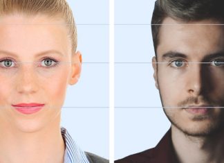 Alın bölgesine saç ekimi yapılabilir mi? Alın bölgesine saç ekimi yapılabilir mi?