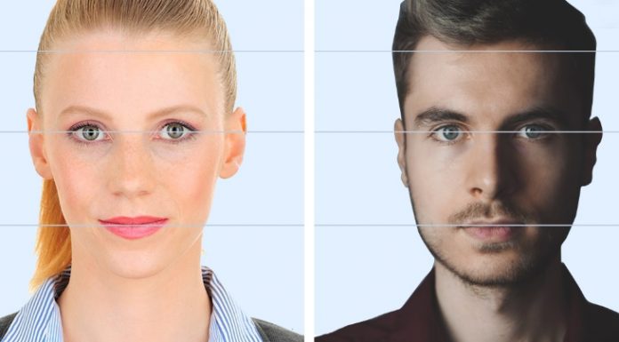 Alın bölgesine saç ekimi yapılabilir mi? Alın bölgesine saç ekimi yapılabilir mi?