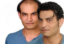 Protez Saç Seçimi Yaparken Dikkat Edilmesi Gerekenler Protez Saç Seçimi Yaparken Dikkat Edilmesi Gerekenler