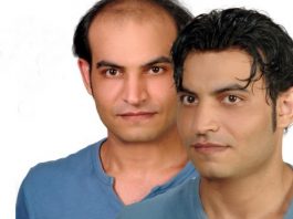 Protez Saç Seçimi Yaparken Dikkat Edilmesi Gerekenler Protez Saç Seçimi Yaparken Dikkat Edilmesi Gerekenler