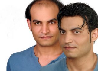 Protez Saç Seçimi Yaparken Dikkat Edilmesi Gerekenler Protez Saç Seçimi Yaparken Dikkat Edilmesi Gerekenler