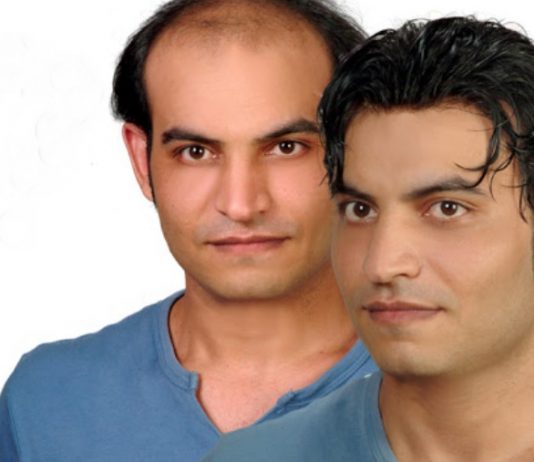 Protez Saç Seçimi Yaparken Dikkat Edilmesi Gerekenler Protez Saç Seçimi Yaparken Dikkat Edilmesi Gerekenler