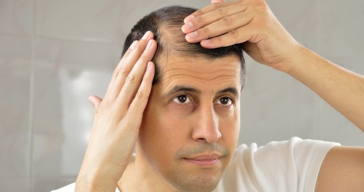 Saç ekiminin yan etkileri veya zararı var mı?