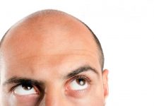 Saç ekiminin yan etkileri veya zararı var mı? Saç ekiminin yan etkileri veya zararı var mı?