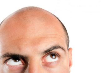 Saç ekiminin yan etkileri veya zararı var mı? Saç ekiminin yan etkileri veya zararı var mı?