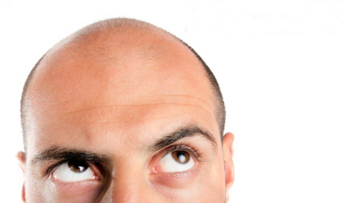 Saç ekiminin yan etkileri veya zararı var mı?