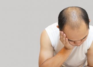 SGK saç ekimi ücretini karşılar mı? SGK saç ekimi ücretini karşılar mı?